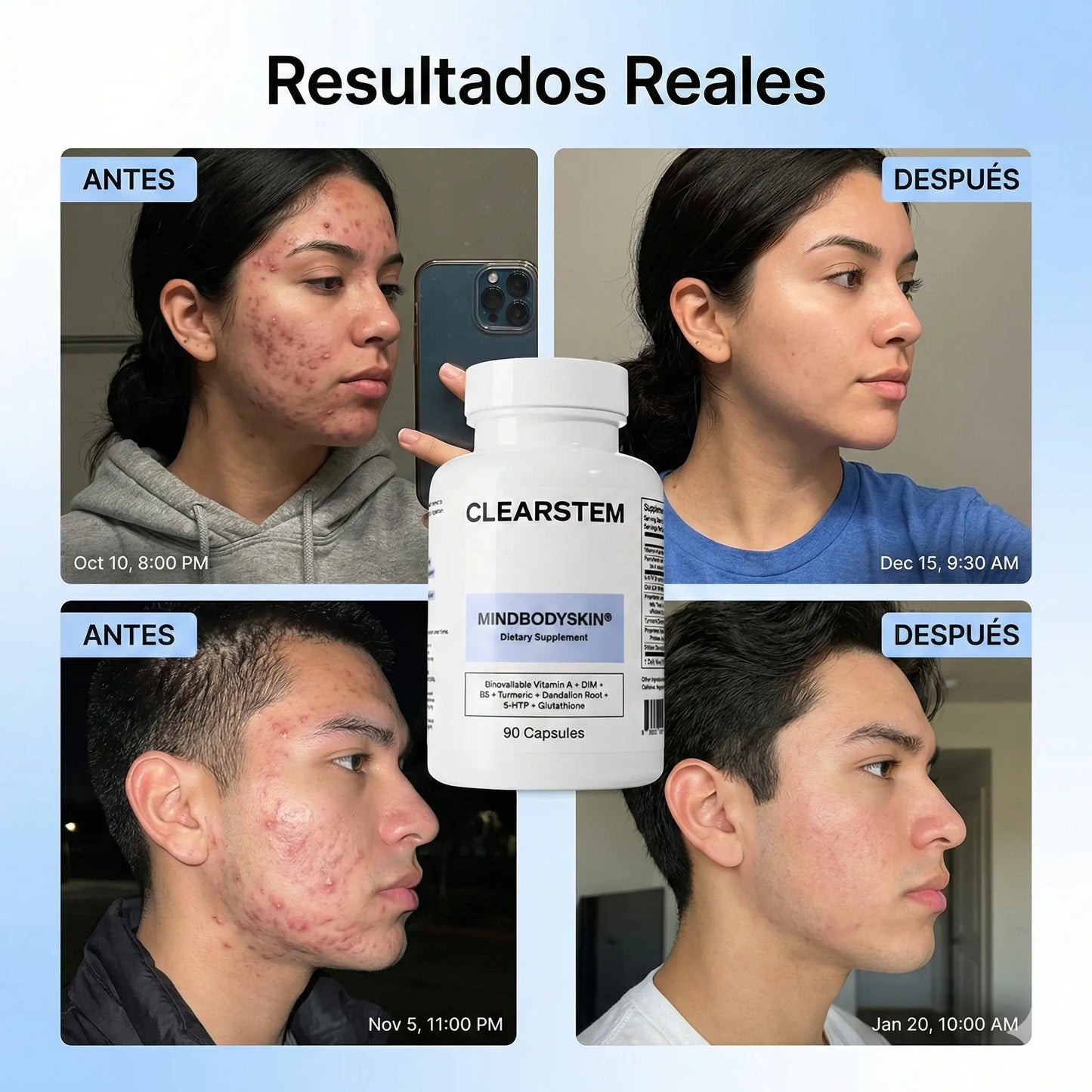 MINDBODYSKIN Clearstem - Acaba con el Acné Hormonal en 7 Días.