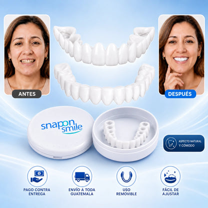 SnapSmile™ — Sonrisa Perfecta en Segundos, Sin Dentista. Par de Carillas