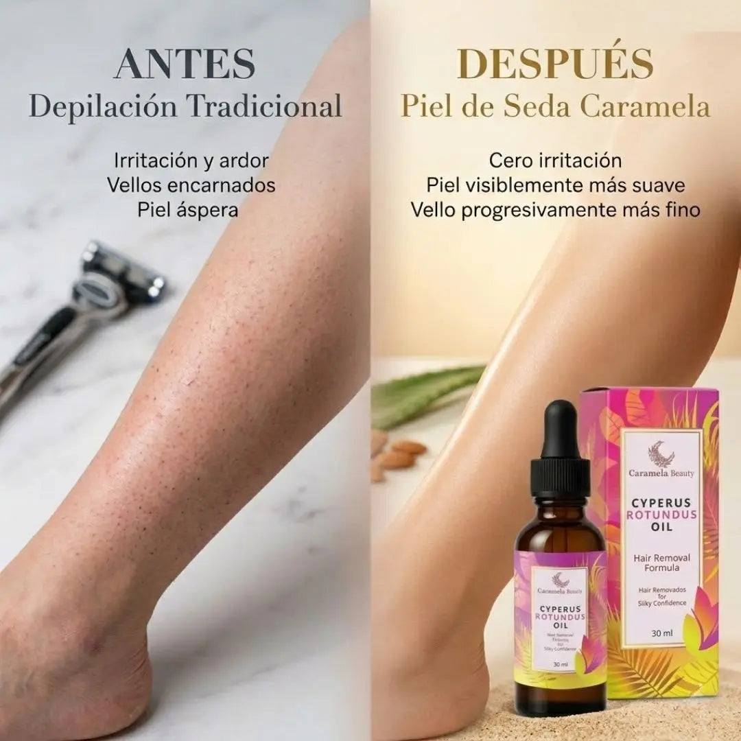 Cyperus Rotundus Oil | Menos vello, piel más suave por más tiempo